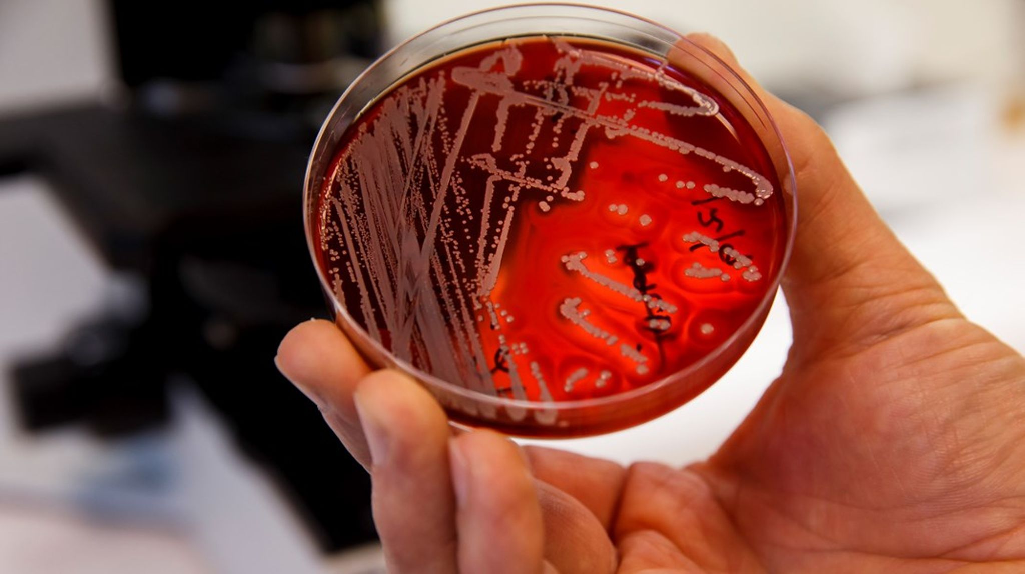 Antibiotikaresistens är en av Sveriges prioriteringar inom hälso- och sjukvårdsområdet under EU-ordförandeskapet. 