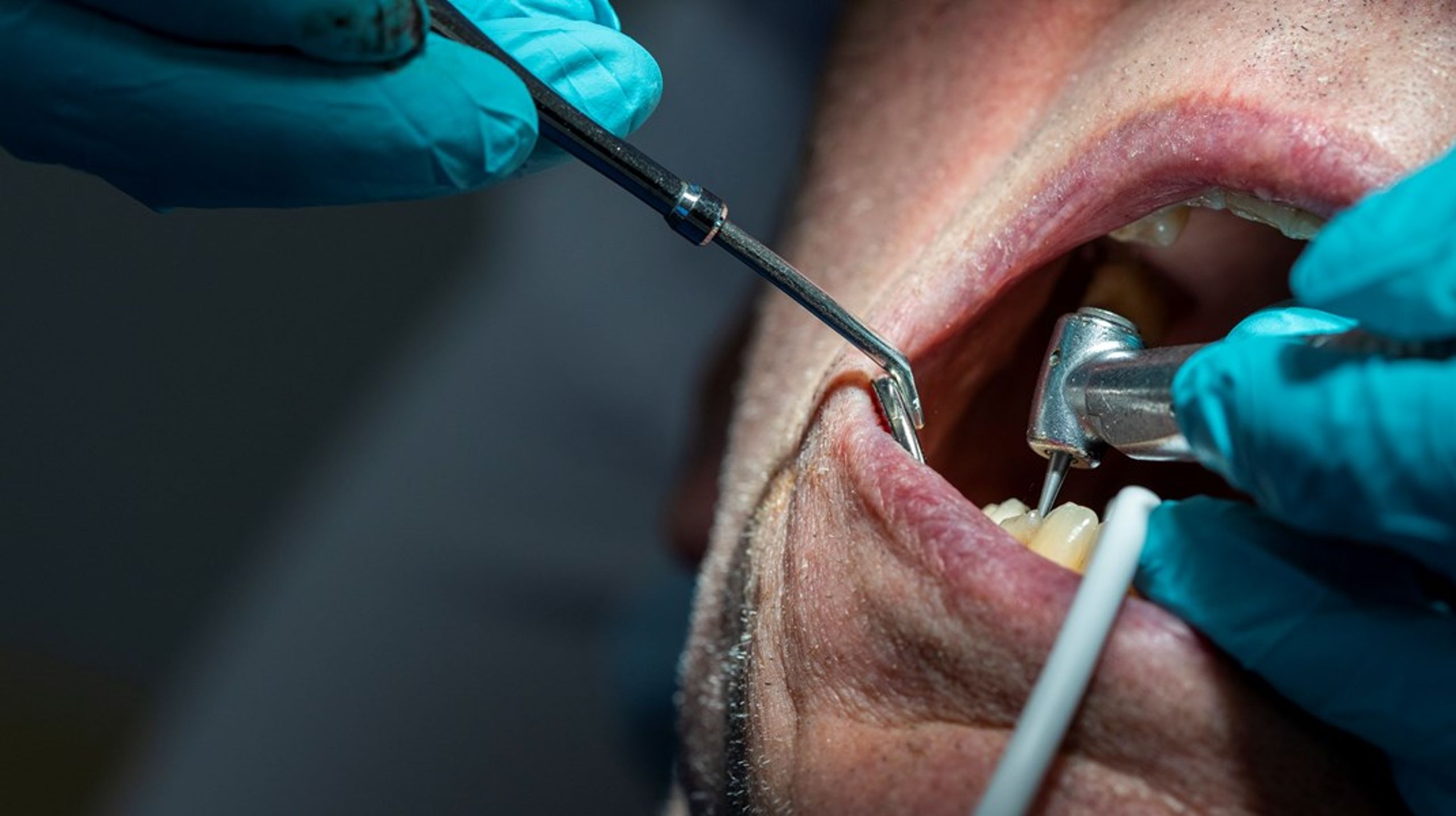 ”En stor risk med en utebliven tandvårdskontakt är en försämrad munhälsa.”