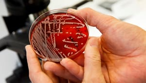 Antibiotikaresistensen hotar att ”skicka oss tillbaka till den förantibiotiska eran”