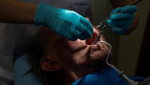 Tandvård i högkostnadsskyddet löser inte problemen