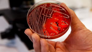 Antibiotikaresistens är den tysta pandemin